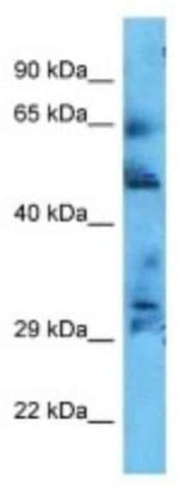 CCDC181 Rabbit anti-Human, Polyclonal, Novus Biologicals 100 &mu;g; Unconjugated:Antibodies,
